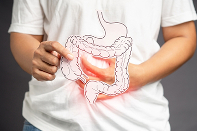 Irritable-Bowel-Syndrome-IBS